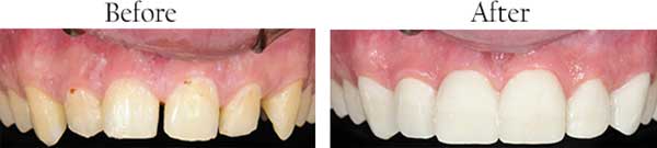 dental images 60640